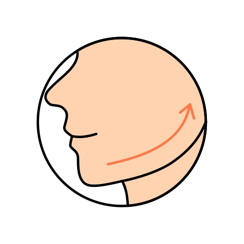 Fadenlifting im Gesicht (Kosmetische Medizin)