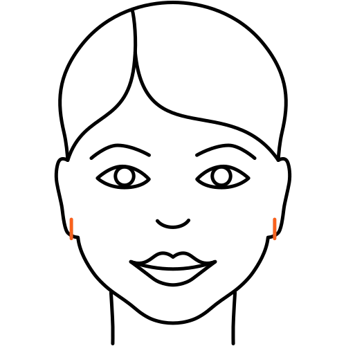 Ohrläppchen Korrektur (Kosmetische Medizin)